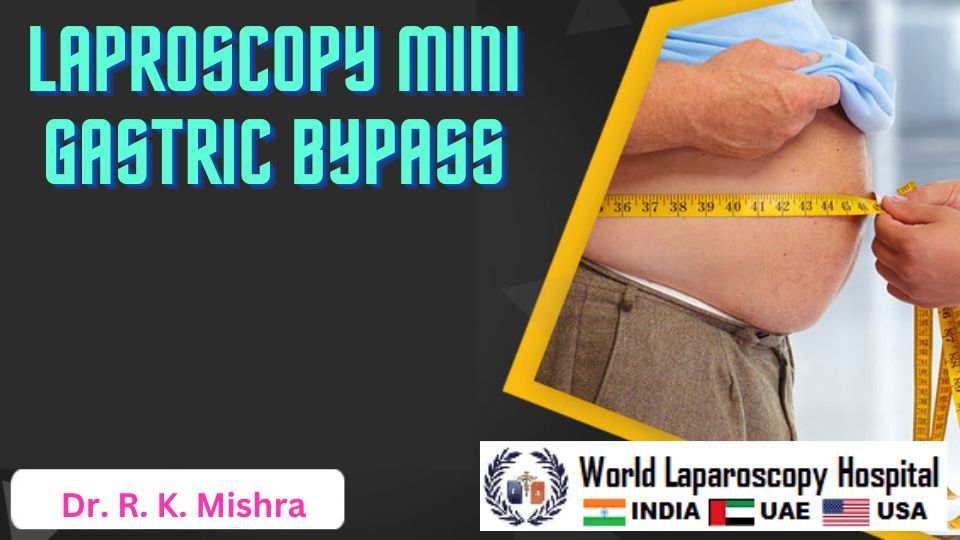 Post Operative Care After Laparoscopy Mini Gastric Bypass 